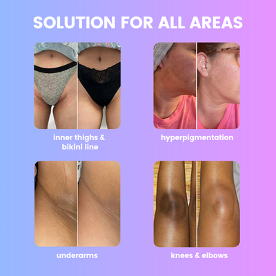 Underarm Brightening Deodorant Cream