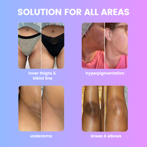 Underarm Brightening Deodorant Cream